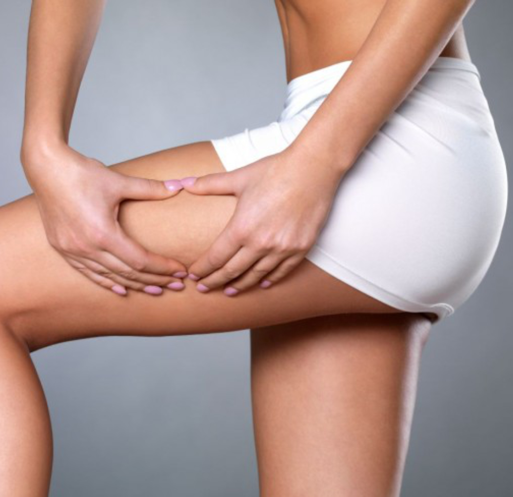 Velashape III tretman za butine i zadnjicu