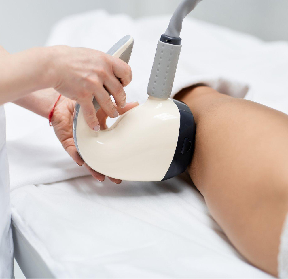 Velashape III tretman za butine i zadnjicu