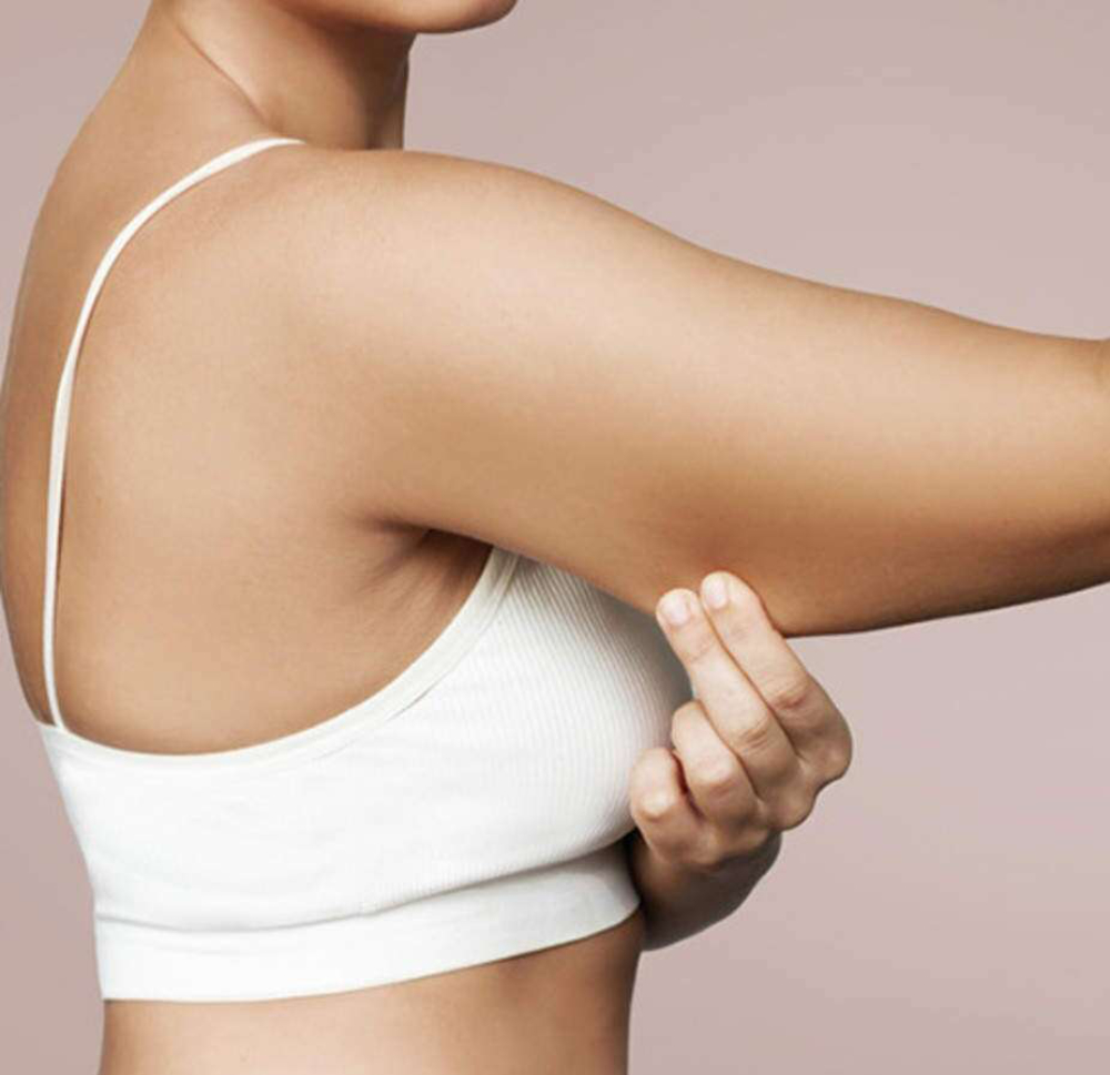 velashape-3-nadlaktice4